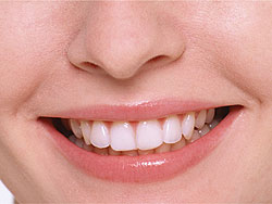 �I�t�B�X�z���C�g�j���O-�p��