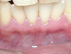 �����̕Y��-�p��